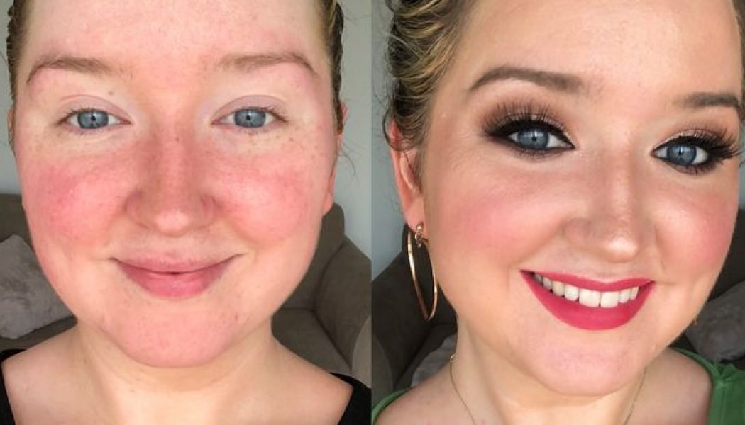 14 Redness-Reducing Products I Swear By Since Being Diagnosed With Rosacea