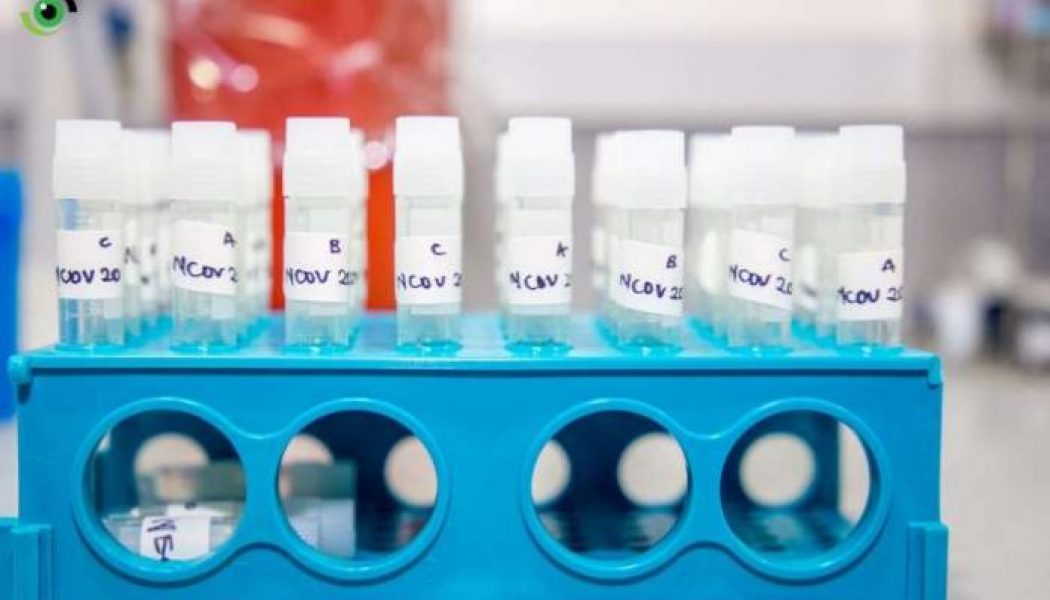 Plateau counter NCDC on number of coronavirus cases