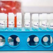 Plateau counter NCDC on number of coronavirus cases