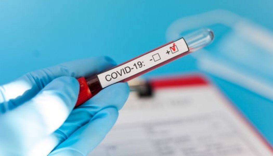 Nigerians Urged To Do COVID-19 Testing As Infection Record Hits 20244 In 19 States