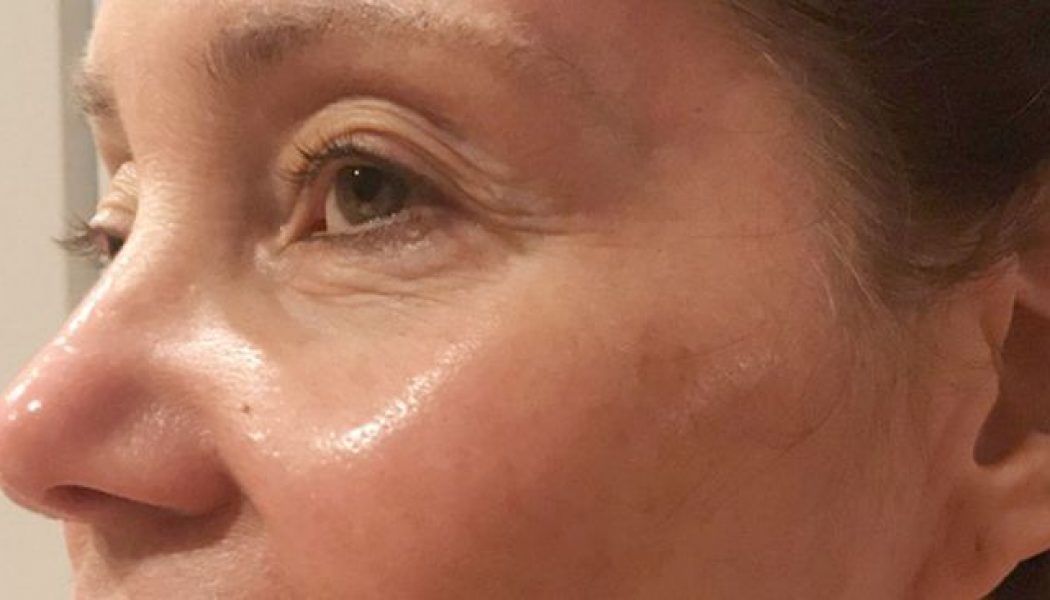 People Don’t Believe My Mom Is 71—Here Are 8 Anti-Ageing Serums She Uses