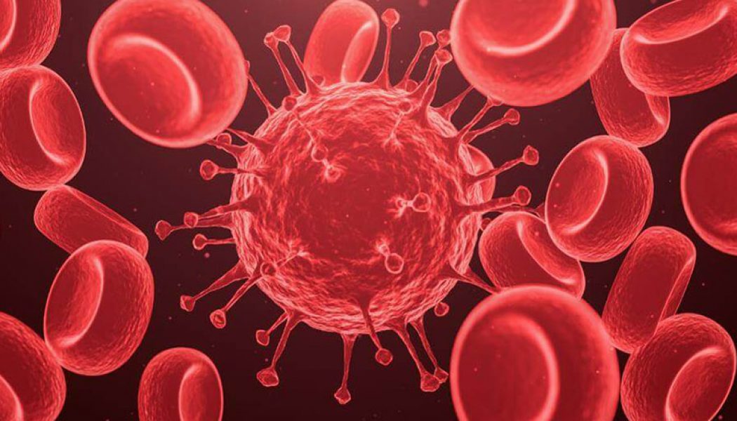 PLWSCD are at Higher Risk of Complications when Infected with COVID-19