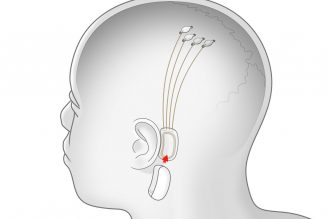 Elon Musk Says People Will Eventually Consume Music Through Brain Chip