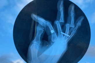 Tony Hawk Teams Up with The Avalanches to Sell One-of-a-Kind X-Ray Vinyl for Charity