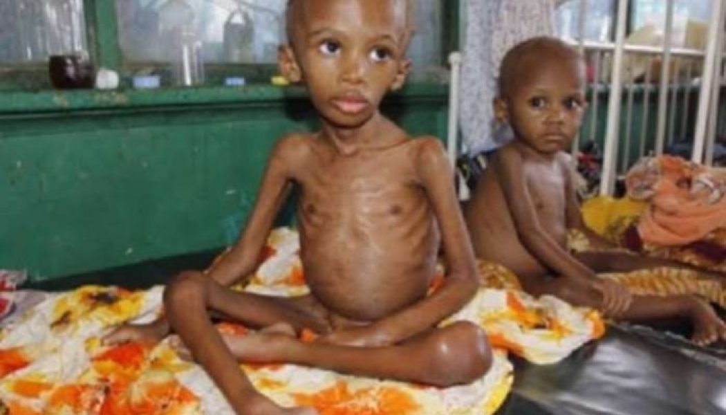 Kaduna loses 124 children to malnutrition in 9 months