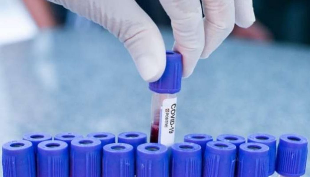 U.S. records 247,403 new coronavirus infections, 3,656 deaths