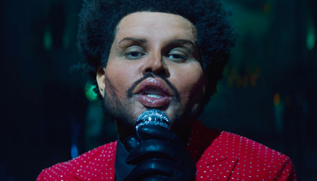 The Weeknd Shows Off Horrifying Plastic Surgery in New Video for “Save Your Tears”: Watch