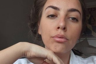 I’ve Had Dark Circles All My Life, and These Are the Only Products That Work