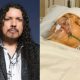 STRYPER’s OZ FOX Undergoes First Brain Surgery