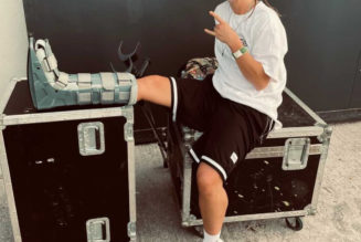 Hannah Wants Performed With a Broken Leg After a Scooter Accident in Ibiza