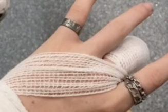 A 16-Year-Old Lost Her Fingertip In a Mosh Pit at Reading Festival
