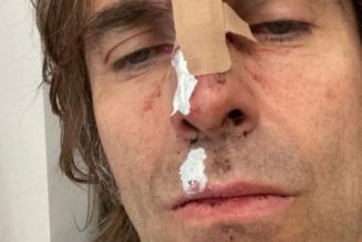 Liam Gallagher Says He Fell Out of a Helicopter