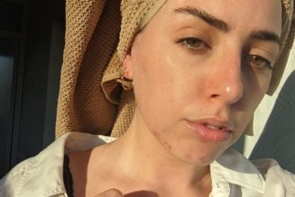 I Developed Acne in My Late 20s—This Is Everything My Dermatologist Taught Me