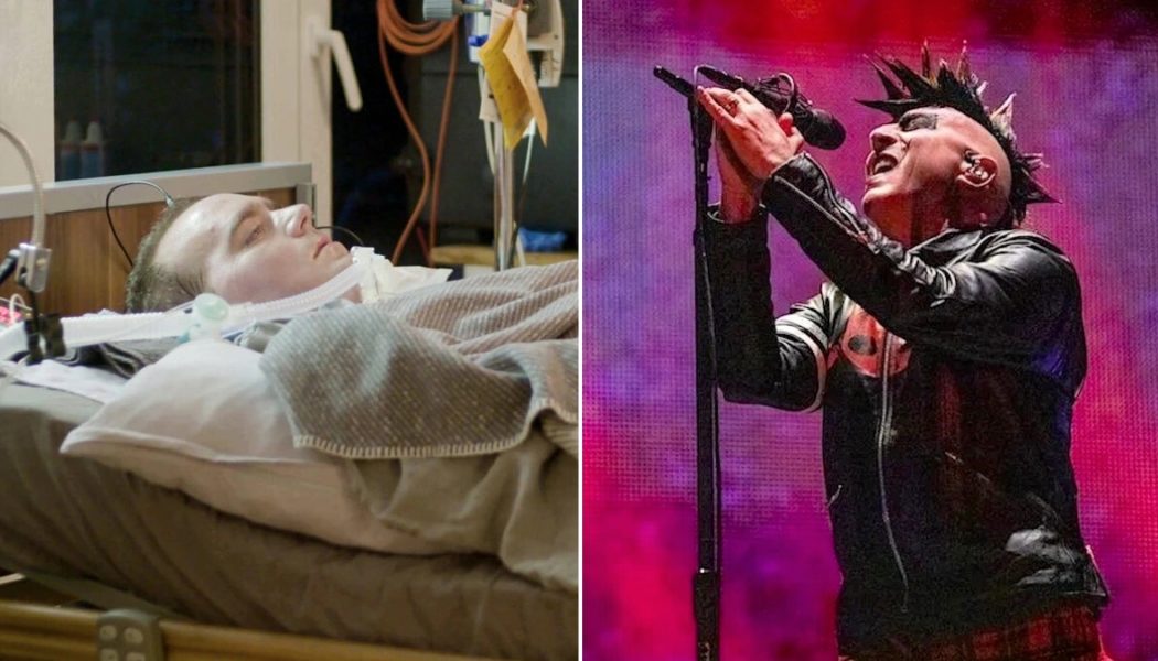 ALS Patient with Complete Paralysis Asks to Hear Tool Album via Brain Implant