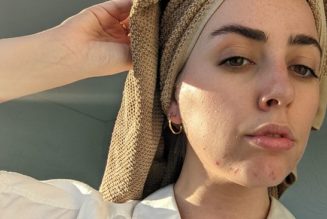 I Have Acne Scarring, and These Are the Only Products That Help