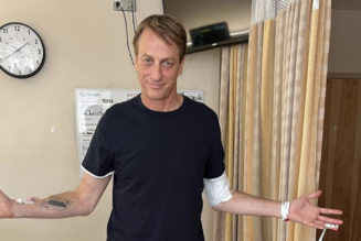 Tony Hawk Broke His Leg and Says He May Not Make a Full Recovery