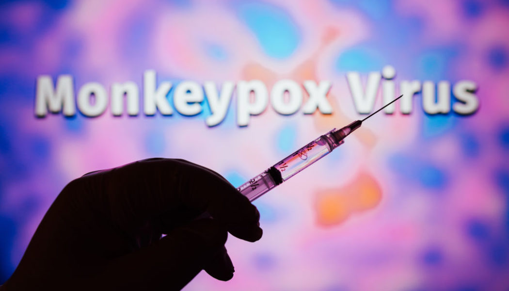 What Is Monkeypox And Its Health Risks?