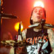 Travis Barker Recovering from “Severe Life Threatening Pancreatitis”
