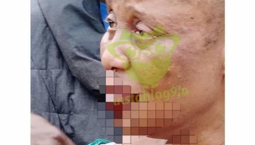 Ekiti pastor assaults and breaks his sister’s lip over money