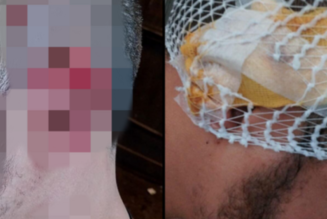 Woman Attacks Bouncer, Bites Off Part of His Ear at Israeli Nightclub: Report