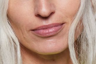 Dermatologists Say These 6 Treatments Are Best for Lip Lines