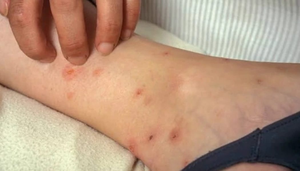 Check Your HIV Status Once You Begin To Notice These Signs In Your Body