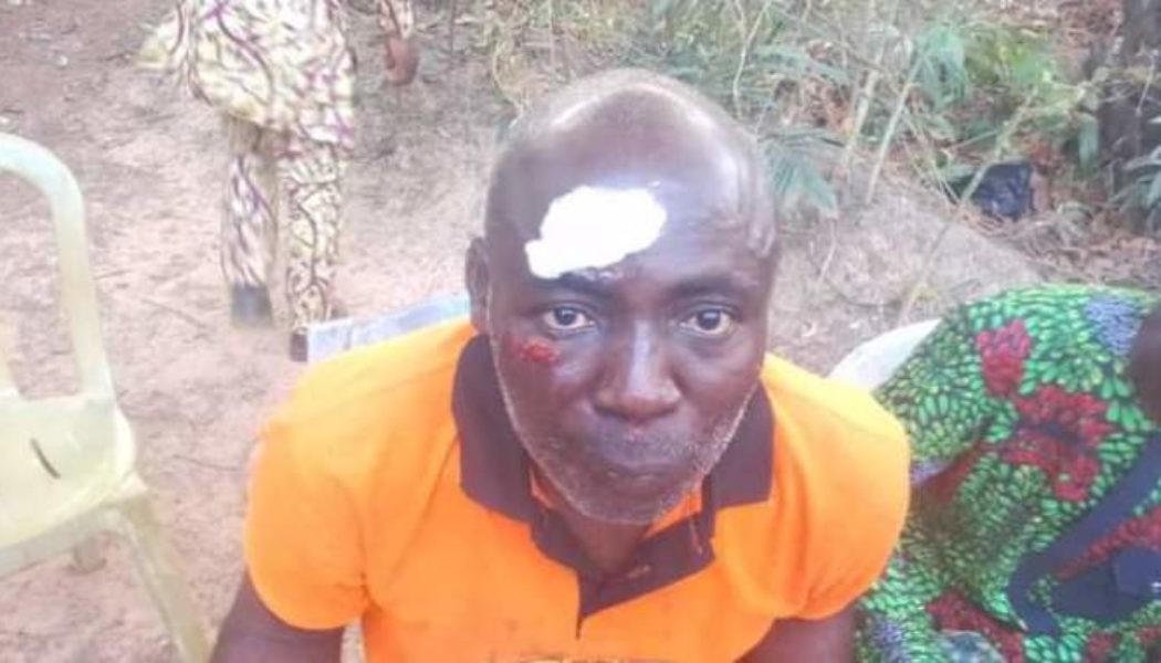 2023 : APGA Governorship Candidate’s Supporter Attacked In Ebonyi State (Photos)