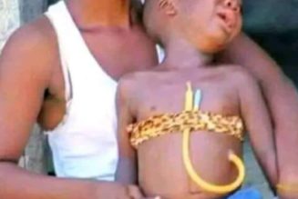 Father Seeks ₦500,000 For 10-year-old Son’s Surgery