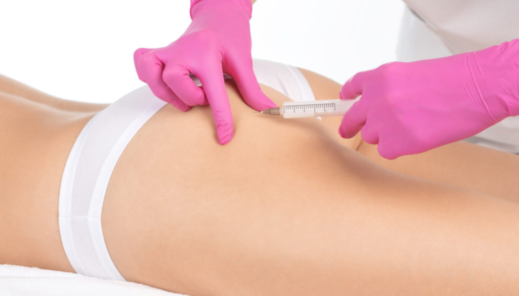 Bootleg Plastic Surgeon Arrested After Allegedly Giving A Kim Kardashian Look-Alike Fatal Illegal Butt Injections