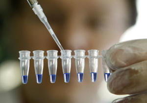 Seitz steht den DNA-Tests aus dem Internet kritisch gegenüber, vor allem wenn die Daten ausserhalb der EU gelangen. (Symbolbild)