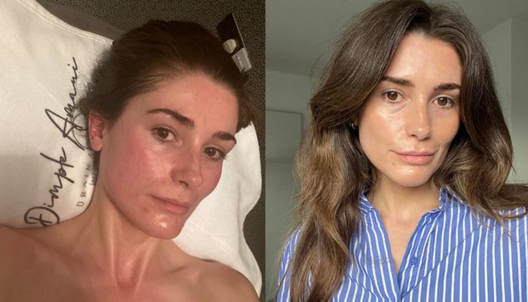 I Just Tried the Sculpting Buccal Facial Celebrities Swear By—My Jaw Dropped