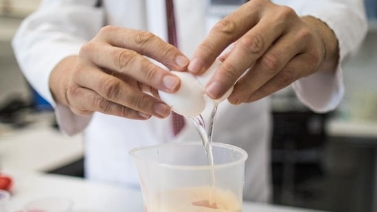 4. Food Sensitivity Testing: In some cases, weight gain may be linked to underlying food sensitivities or intolerances. Food sensitivities can trigger inflammation and water retention, leading to temporary weight gain. While healthy foods may not directly cause weight gain, a person may unknowingly consume foods to which they are sensitive. Identifying and eliminating these trigger foods from the diet can lead to weight loss and improved well-being.&nbsp;(File/AFP)