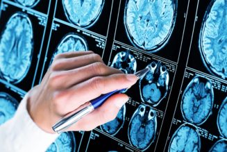 15 health and lifestyle risk factors for young-onset dementia revealed in new study