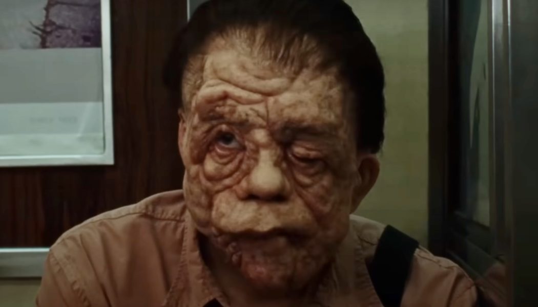 Sebastian Stan undergoes a radical transformation in A24's A Different Man trailer