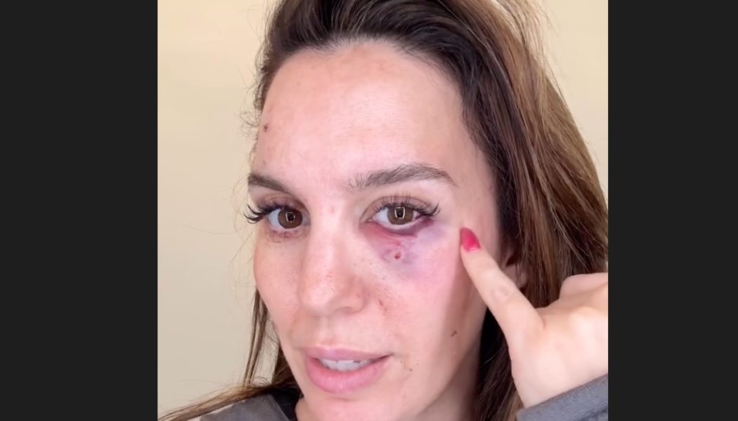Christy Carlson Romano Shot in Face at Clay Pigeons Range