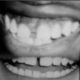 Rex Orange County x Daniel Caesar Drop Two New Tracks
