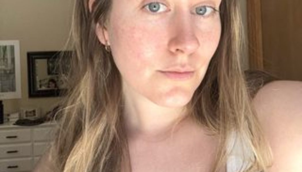 I Tried This At-Home Micro-Needling System—Now, My Favorite Concealers Are Collecting Dust