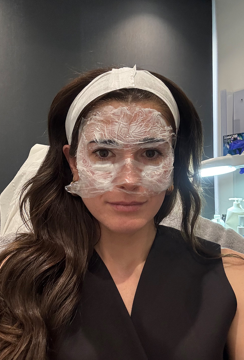 Eleanor wearing numbing cream prior to her Sofwave treatment
