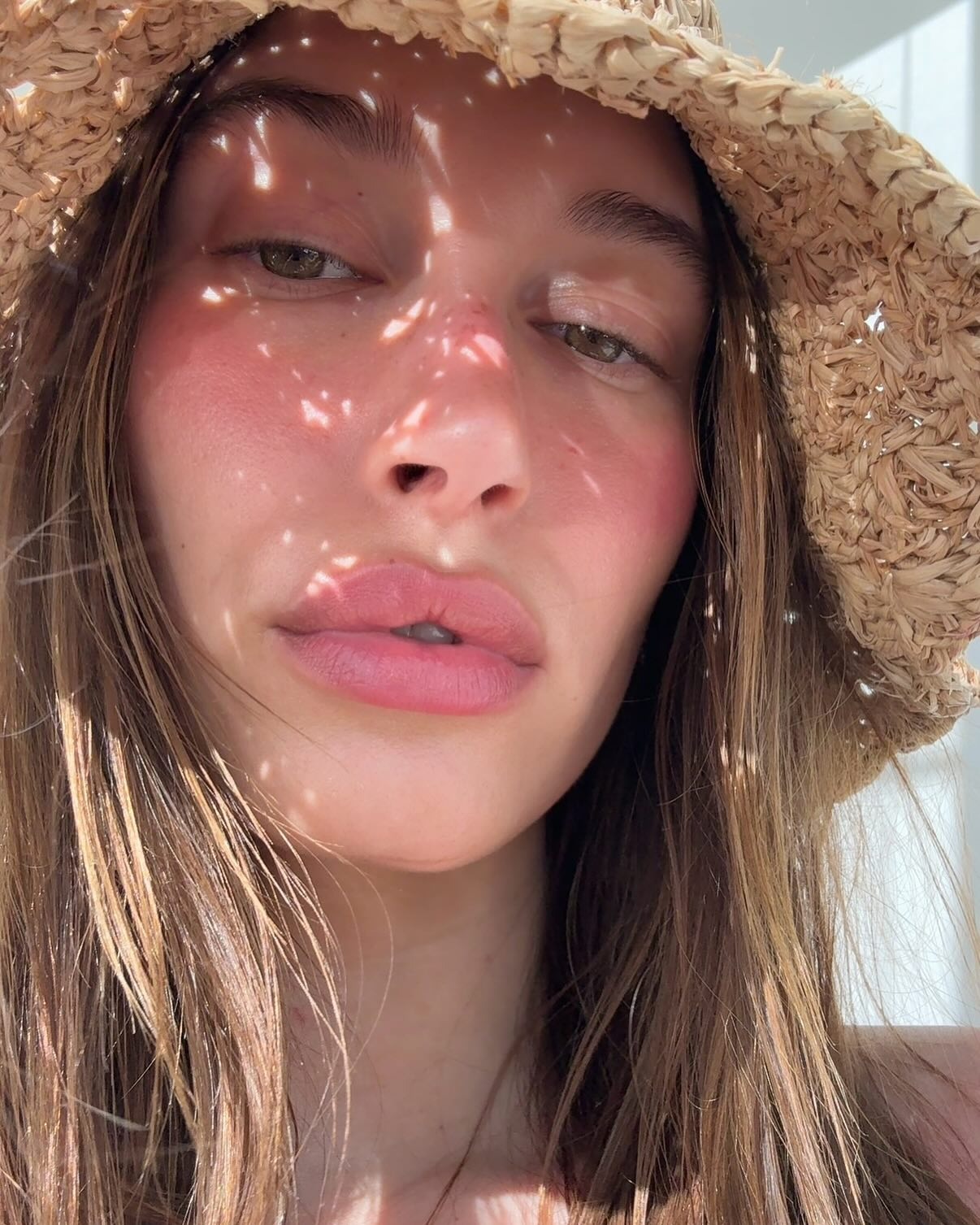 Hailey Bieber with &quot;sunburn&quot; blush