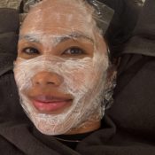 I Traveled to Korea for Salmon Sperm Injections and Was Turned Down—Meet the Under-the-Radar Laser I Tried Instead