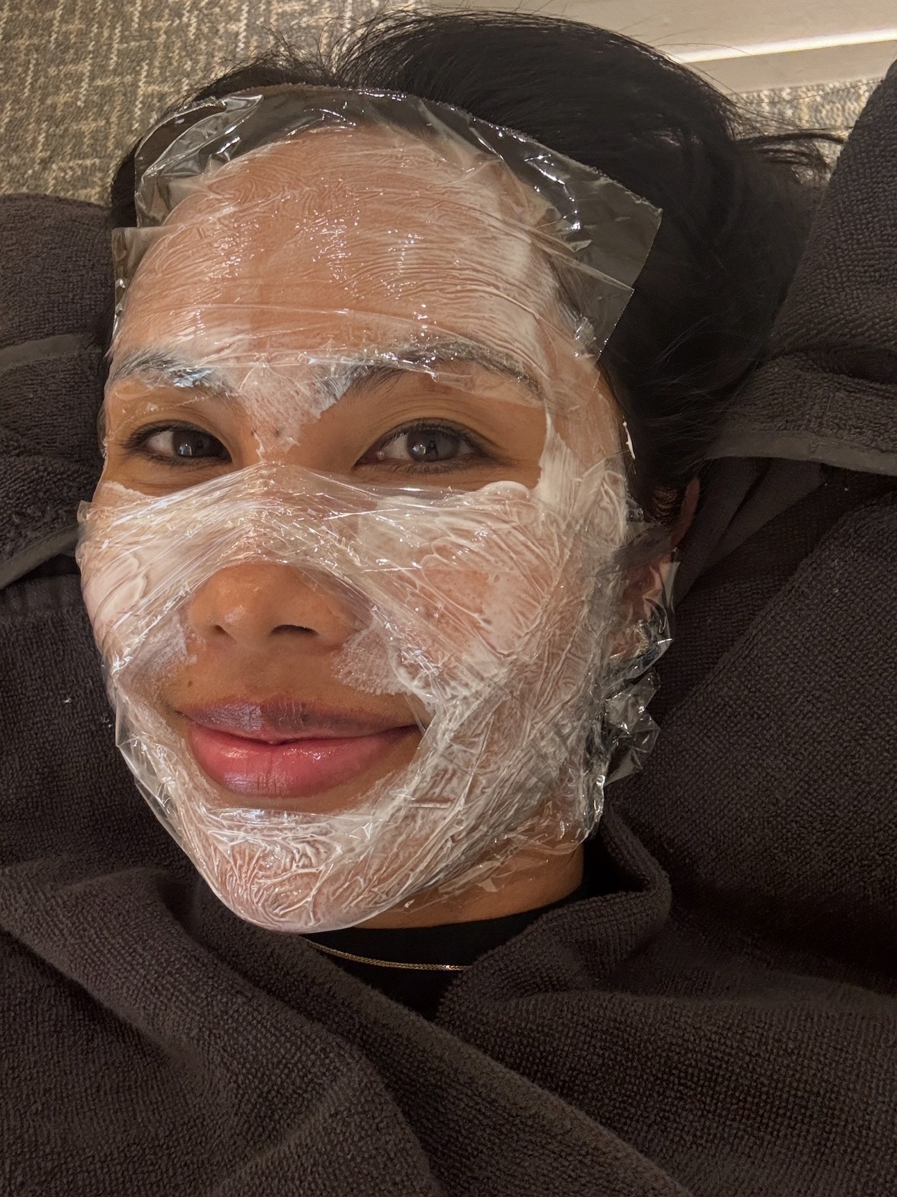 Vanessa Lee PicoSure Pro Laser Review