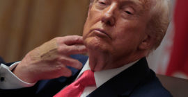 Trump’s Bandaged Hand Caught On Camera Again