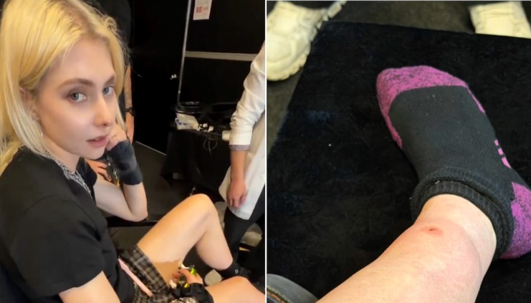 Taylor Momsen Bit By Venomous Spider on AC/DC Tour After Previously Being Bit by Bat