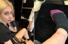 Taylor Momsen Bit By Venomous Spider on AC/DC Tour After Previously Being Bit by Bat