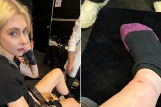 Taylor Momsen Bit By Venomous Spider on AC/DC Tour After Previously Being Bit by Bat