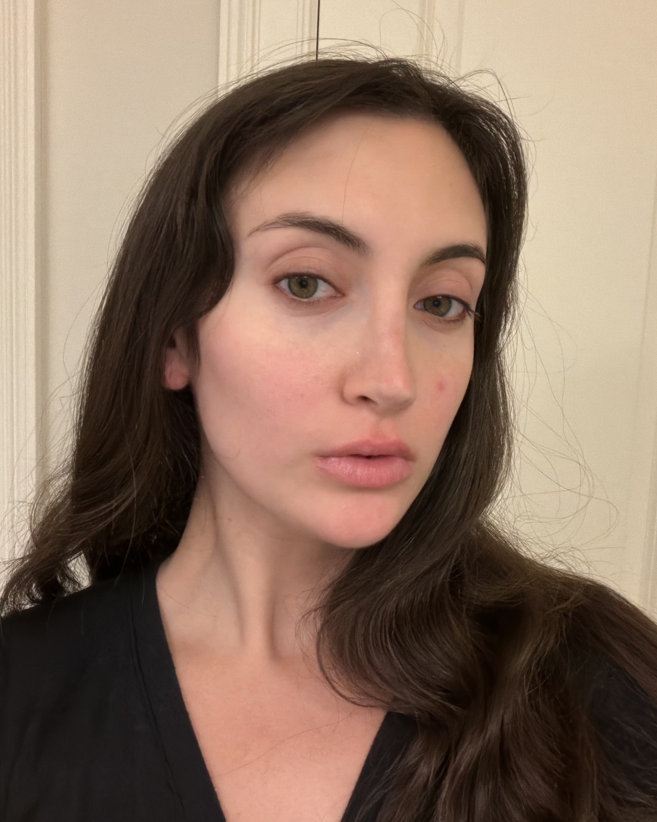 Who What Wear associate beauty editor Alyssa Brascia after using the Omnilux Contour Face Mask.