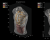 Midjourney goes from generating cat images to full-body ultrasound scans