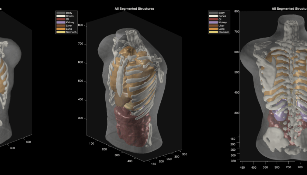Midjourney goes from generating cat images to full-body ultrasound scans