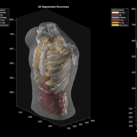 Midjourney goes from generating cat images to full-body ultrasound scans