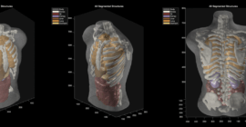 Midjourney goes from generating cat images to full-body ultrasound scans